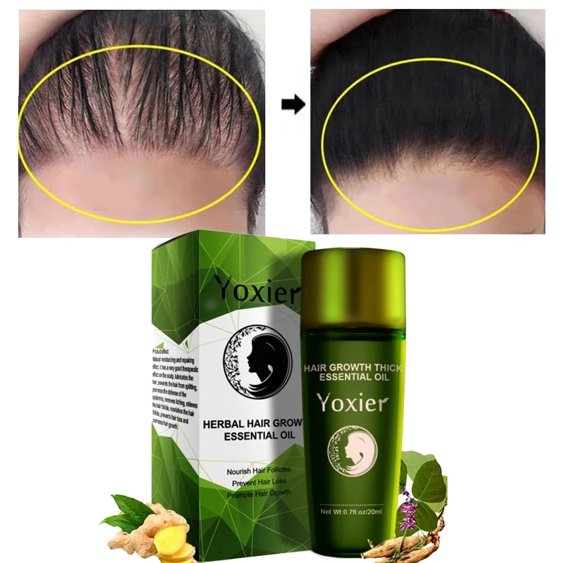 20ml Bitkisel Saç Büyüme uçucu yağ Saç Bakımı Şekillendirici Kalın Hızlı Onarım Büyüme Tedavisi Sıvı Anti-Saç Dökülmesi TSLM1 Görüntü 0
